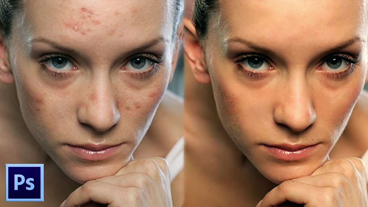 Skin Retouching Photoshop Tutorial Professional Skin Retouching In