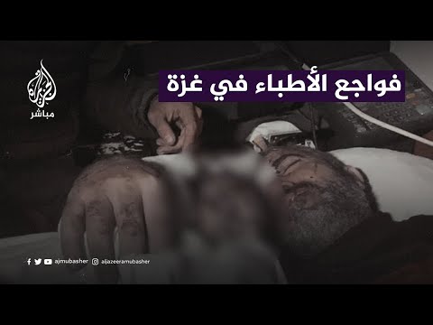 أطباء يروون تفاصيل الحالة الصحية لمدير صحة غزة الدكتور منير البرش