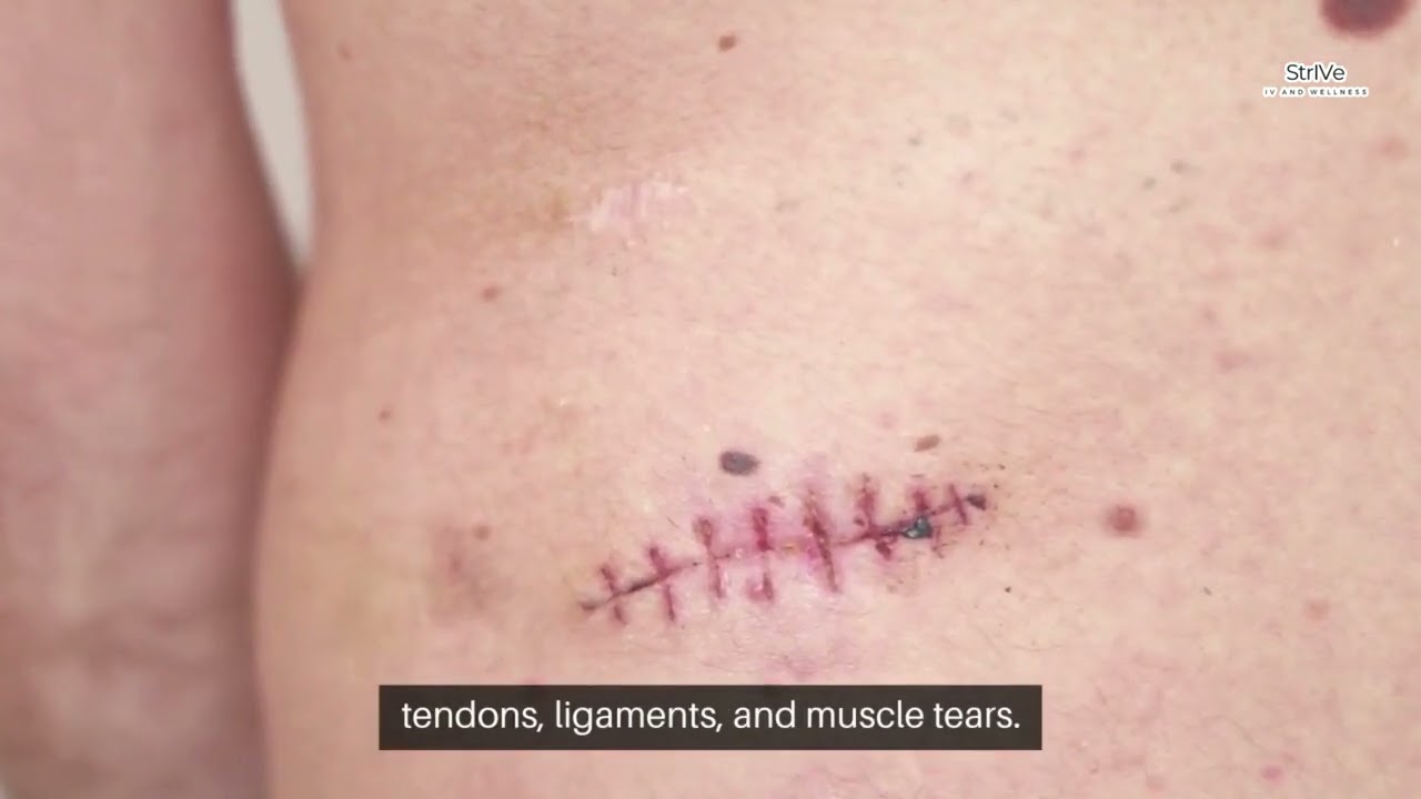 Peptides in New Braunfels, TX: TB-500 Benefits for Healing & Wellness