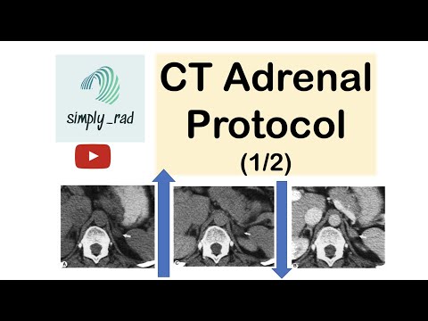 CT Adrenal Protocol (washout) 1/2