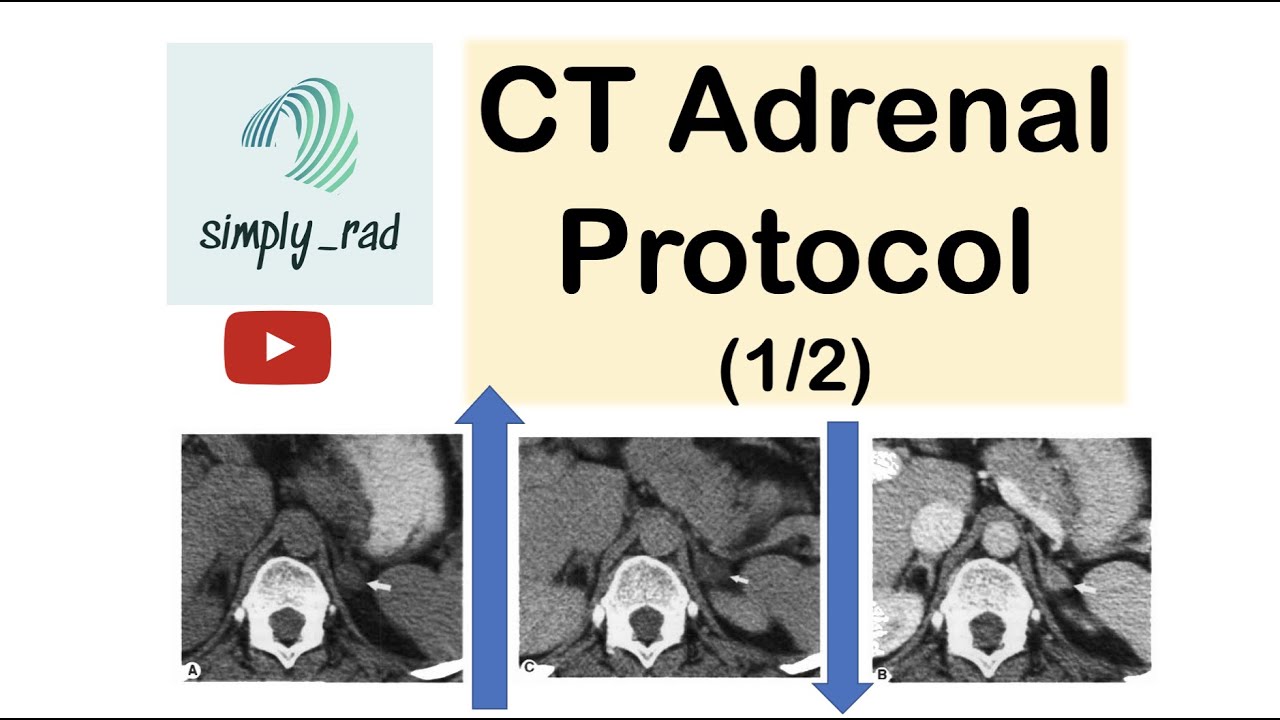 CT Adrenal Protocol (washout) 1/2 YouTube