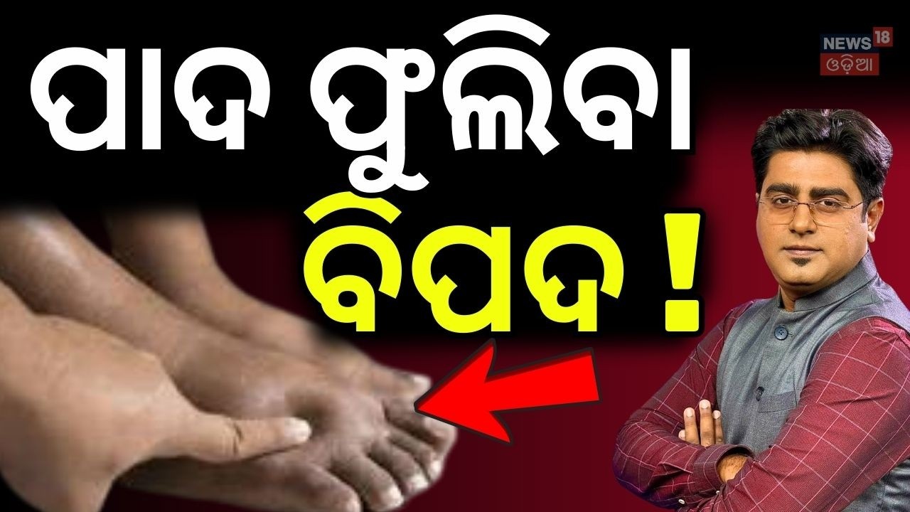 ପାଦ ଫୁଲିବା ବିପଦ ! Best Health Tips to Reduce Foot Swelling | Foot Swelling Problems? Asal Katha