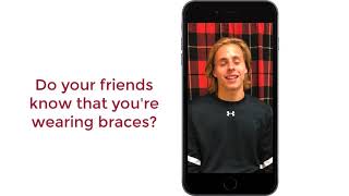 InBrace Lingual Braces Testimonial - Nathan shares his experience