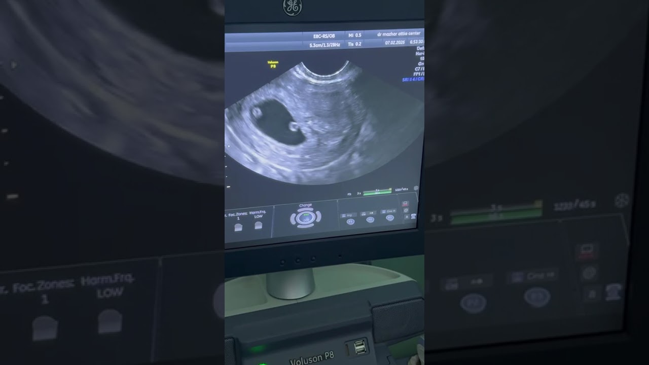 اطمنا على الجنين