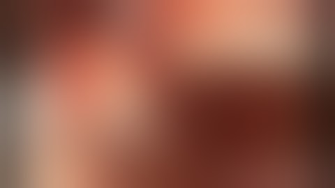 Titanium membrane for horizontal ridge augmentation (I-Gen and Megagen implant)