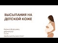 ВЫСЫПАНИЯ НА ДЕТСКОЙ КОЖЕ