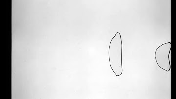 Hele-Shaw 2 bubbles coalescing