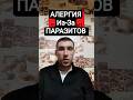 #алергия #паразиты #высыпания #зуд