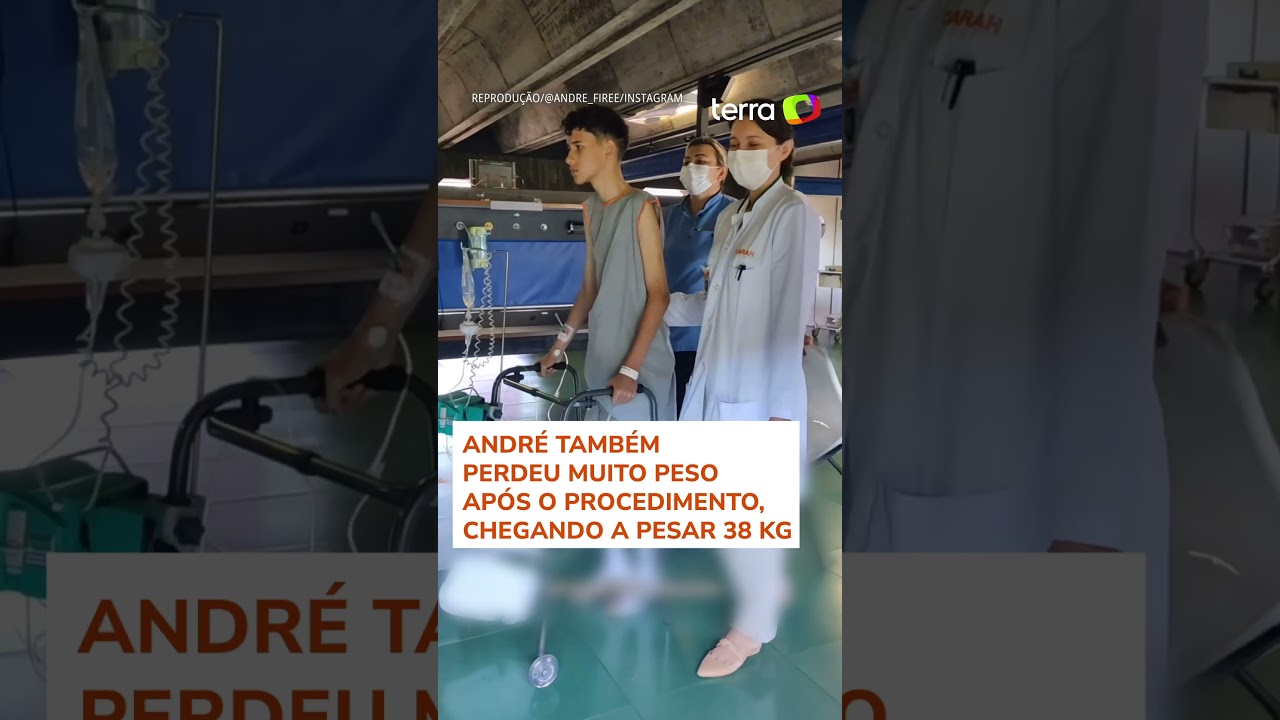 Jovem viraliza ao mostrar evolução no tratamento contra escoliose grave