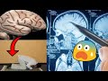 SUBHANALLAH Pakar Neurosains Terkejut Tentang Struktur Otak Dan Korelasi Sujud Dalam Solat