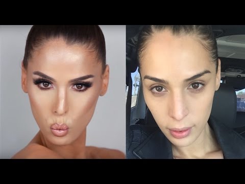dr.-simon-ourian-non-surgical-nose-job-|-carmen-carrera