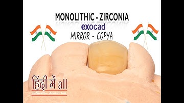 exocad mirroring || Implant Tooth Mirroring || Copy tooth (mirror) exocad || ExoCAD Tutorial