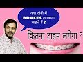 How much time for braces treatment| when you get result by dental braces