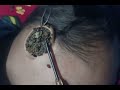 궁극의 귀청소 세션 🎧 | 깊은 이완을 위한 Sido ASMR 사운드