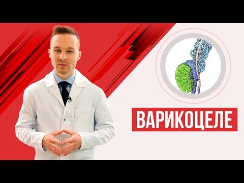 Видео: Варикоцеле - причини, симптоми, диагностика, лечение, операция