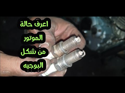 جميع حالات البوجيه