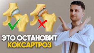 видео: Безопасные упражнения для тазобедренных суставов. Гимнастика для профилактики коксартроза 1-2 степен картинка: Безопасные упражнения для тазобедренных суставов. Гимнастика для профилактики коксартроза 1-2 степен