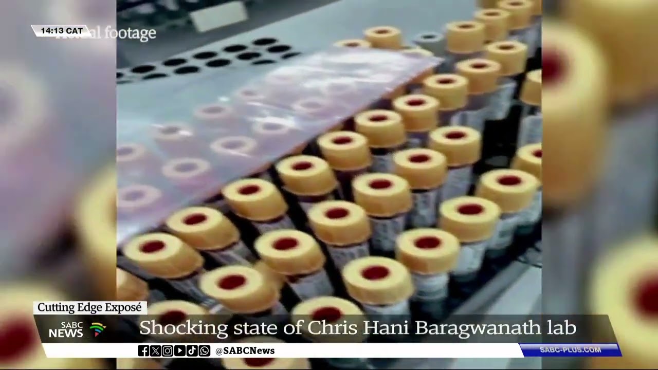 Cutting Edge Exposé | Shocking state of Chris Hani Baragwanath Hospital lab