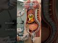 Catheterization is a medical procedure where a tube (catheter) is inserted into the bladder to drain