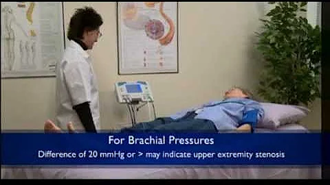 Vantage Summit Doppler ABI Results Waveform Analysis