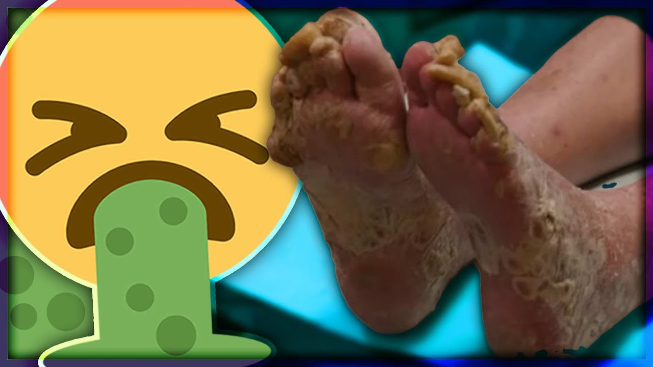 My Feet Are Killing Me The Grossest Moments Of 21 Youtube My Feet Are Killing Me The Grossest Moments Of 21 Youtube