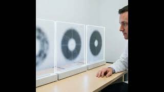 How Fast Does Glaucoma Progress