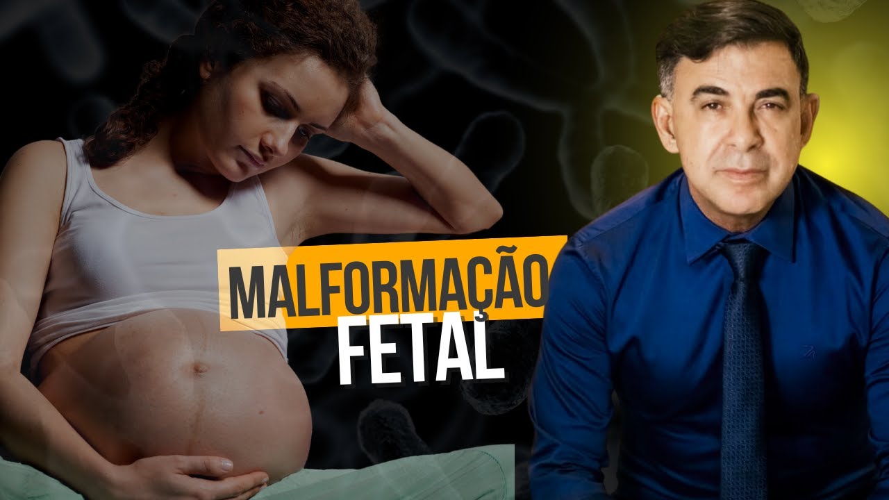 MALFORMAÇÃO FETAL: CAUSAS E OS FATORES DE RISCO - [FETO INCOMPATÍVEL ...