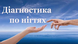 Діагностика здоров'я по нігтях рук. Які хвороби можна визначити по нігтях без гуль-лаку ?