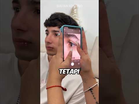 Apa yang dia temukan di matanya sangat mengejutkan! 😱