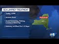 U.S. Fish & Wildlife Department issues water advisory during sea lamprey treatment in Saranac River