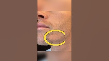 3 tips to grow a beard with a derma roller