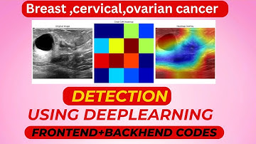 Breast cancer Detection usng Deeplearning | IEEE Based Project 2025-26