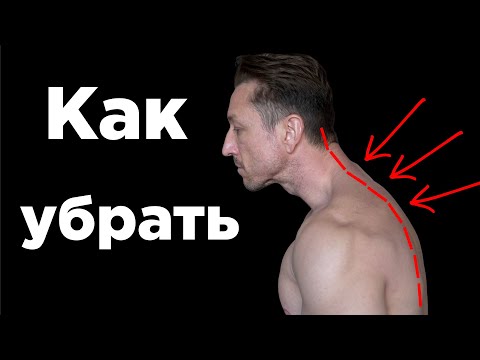 Как УБРАТЬ ХОЛКУ и СУТУЛОСТЬ?!