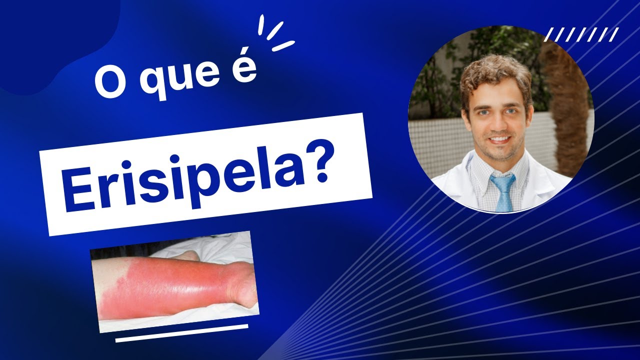 O que é Erisipela? Qual o tratamento da erisipela? - YouTube