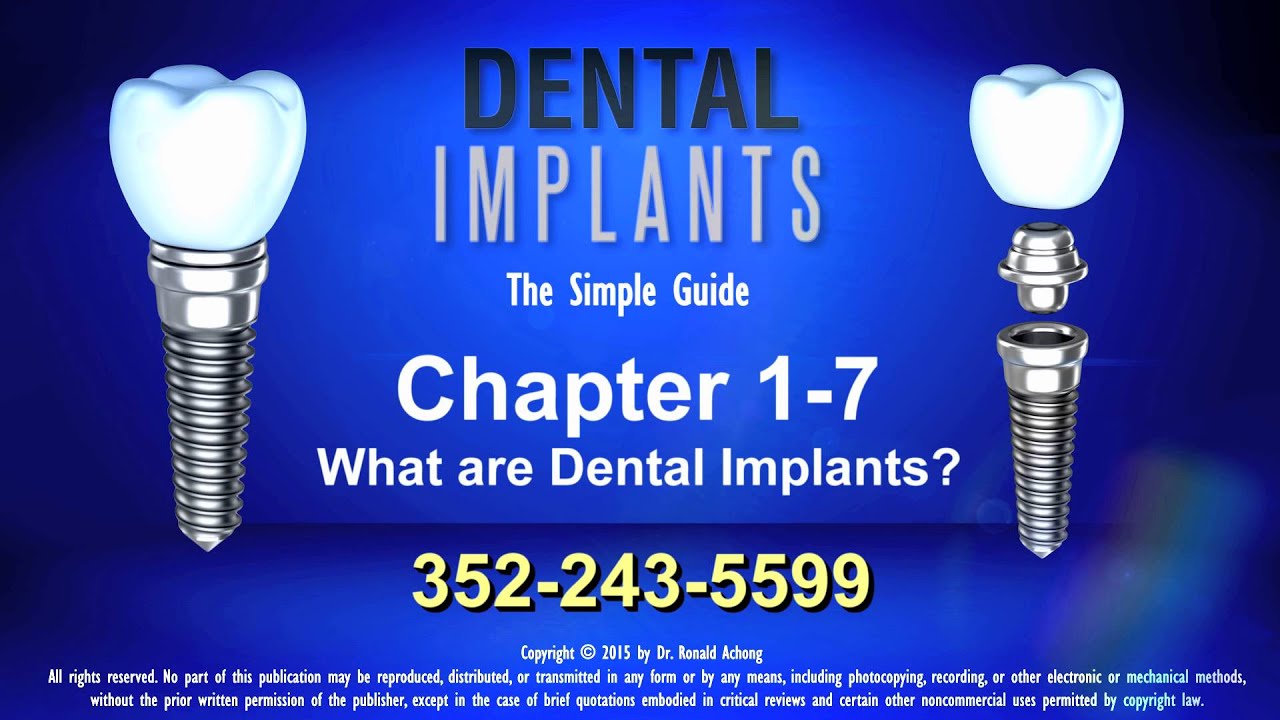 Lake Nona Oral Surgeon explains What are Dental Implants? YouTube