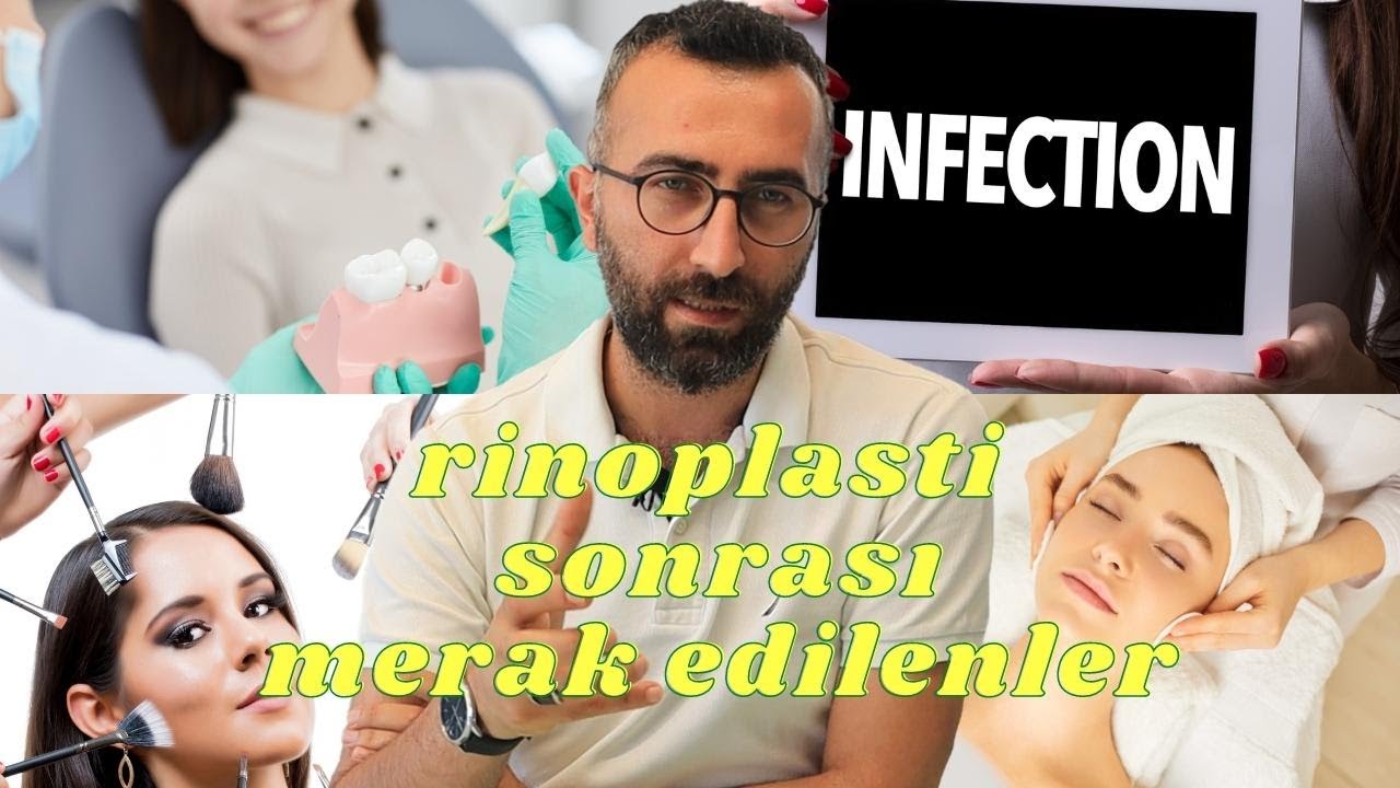 Burun Ameliyatı Sonrası Enfeksiyon, Makyaj Yüz Temizleme, Diş Çekimi...