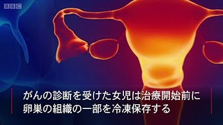 卵巣外で卵子が完全に成長　英大学　がん患者の妊娠に期待