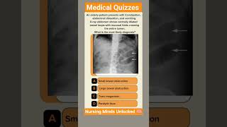 Medical Quizzes #medical #medicalstudent #nursingstudent #medicine #medicaleducation #nursing #gnm