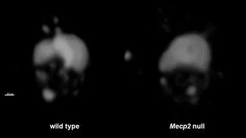 Mandel Compaction