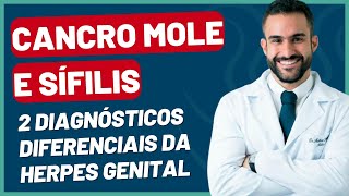 CANCRO MOLE E SÍFILIS: 2 DIAGNÓSTICOS DIFERENCIAIS DA HERPES | DR. MATHEUS AMARAL - UROLOGISTA