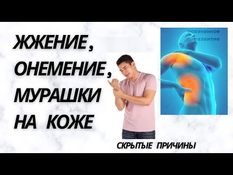 Жжение на коже, покалывание, онемение части тела