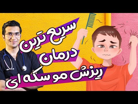 درمان ریزش مو سکه ای