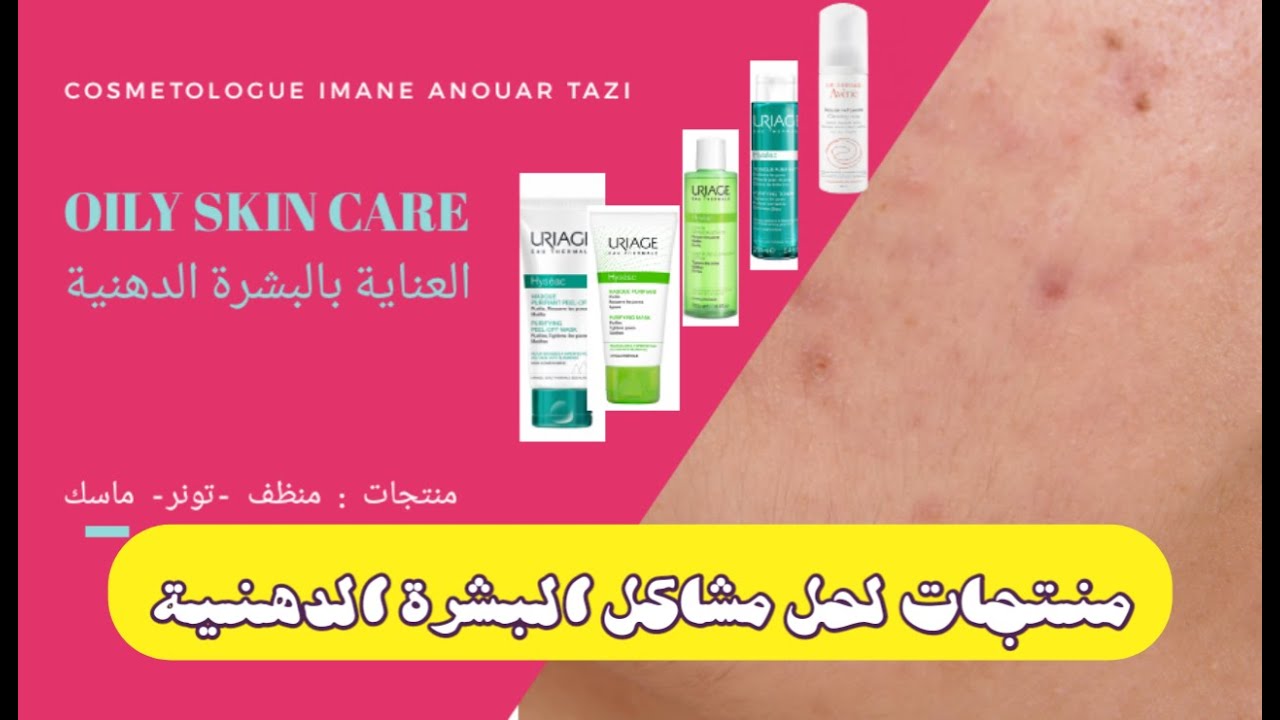 العناية بالبشرة الدهنية: منظف -تونر رائع للبشرة الدهنية- ماسك|مسام حبوب نقط سودا اثار حبوب