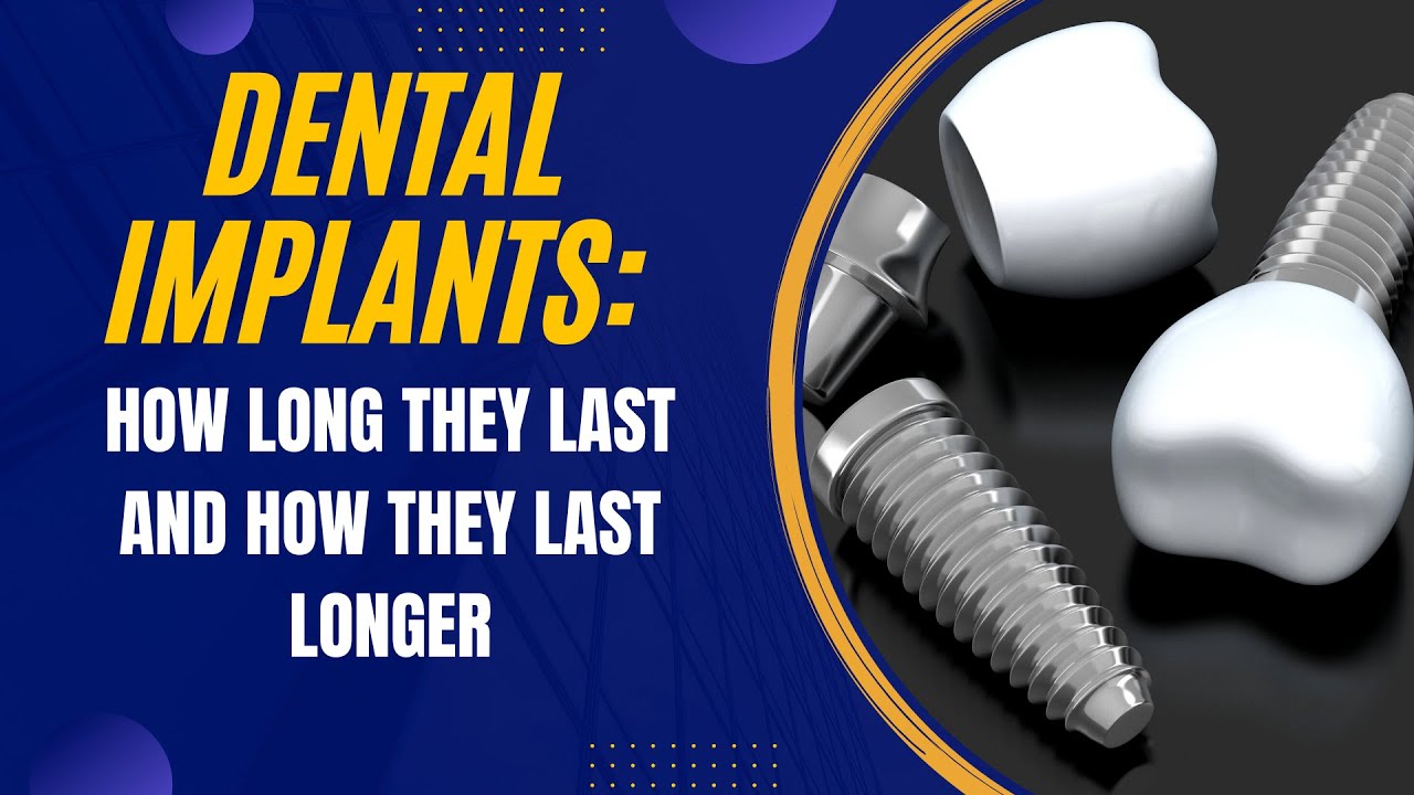 Dental implants how long they last and how they last longer Dental