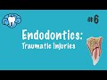 Endodontics | Traumatic Injuries | NBDE Part II