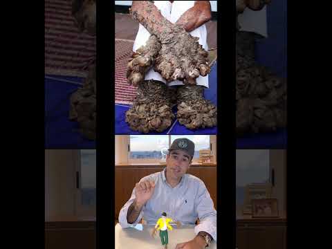 Você conhecia a Epidermodisplasia Verruciforme? YouTube