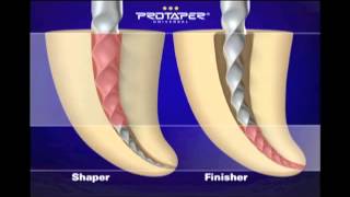 ProTaper® Canal Shaping with Dr. Ruddle