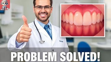 Bleeding Gums: Bleeding Gums: Bleeding Gums Out of Nowhere? Here’s What You Need to Know!