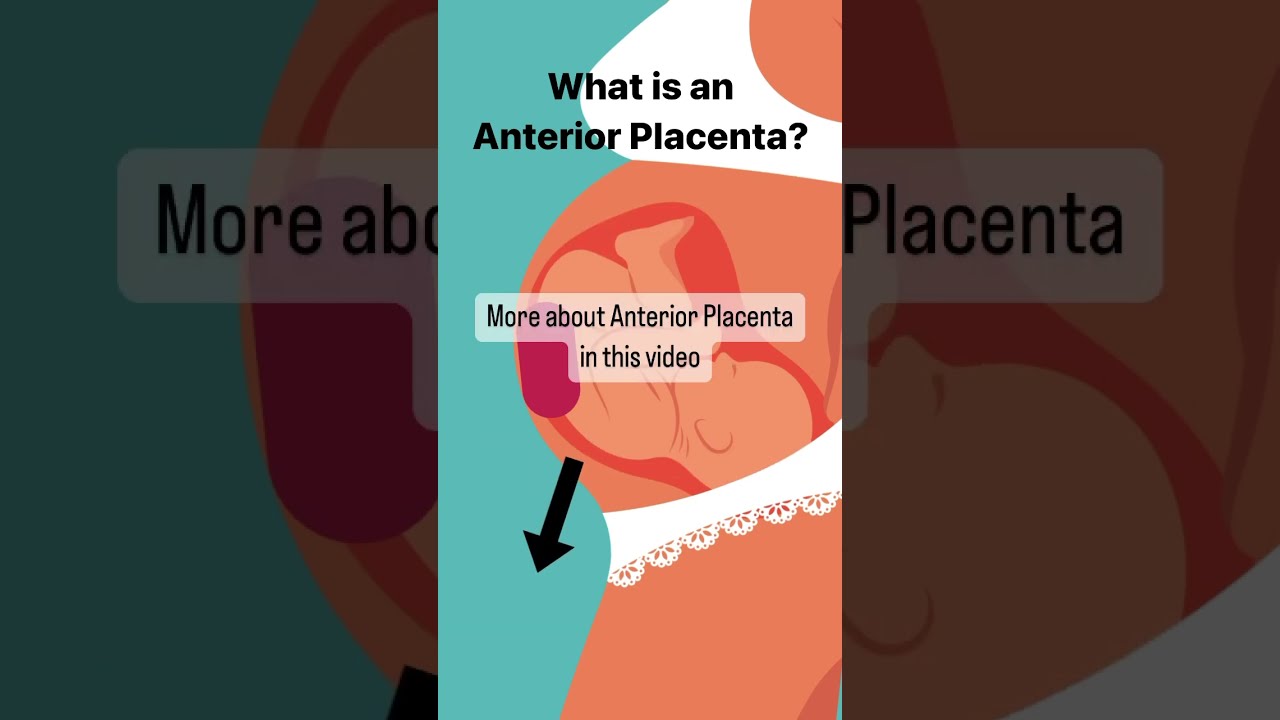What Is Anterior Placenta Pregnant