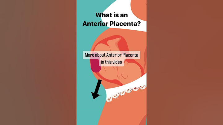 What is Anterior Placenta? #pregnant